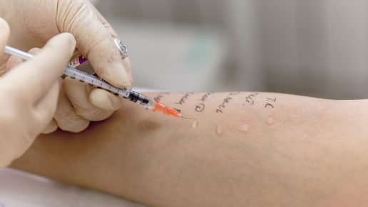 Аллергия канадского сфинкса как лечить thumbnail