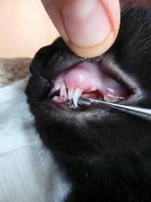 Невыпавший молочный зуб